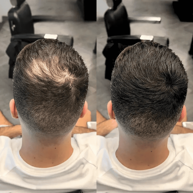 Sevich – Camuflaje Capilar Instantáneo | Acabado Profesional