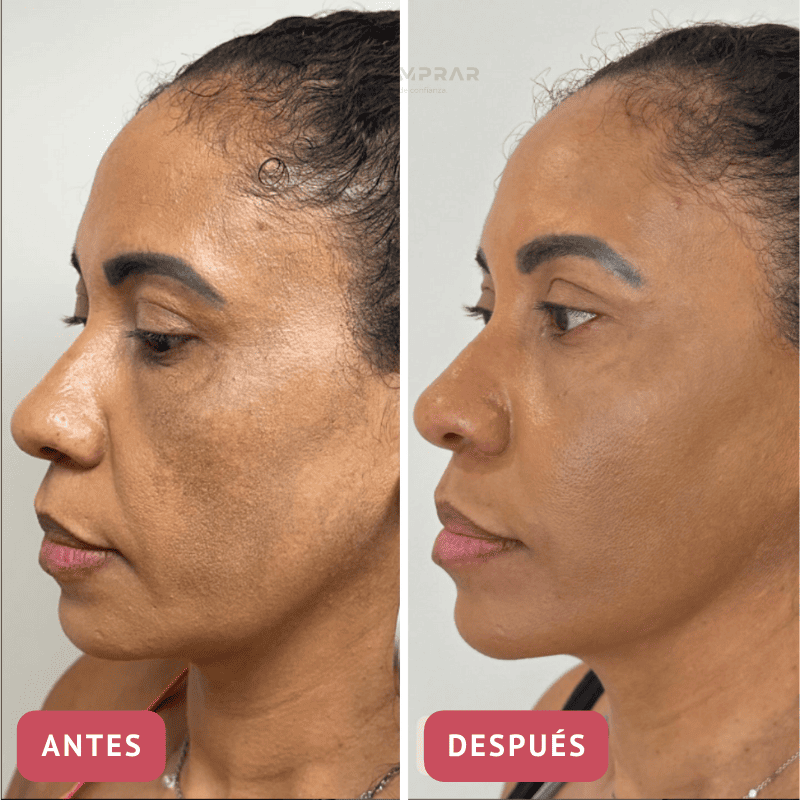 CollageSkin – Mascarilla antiedad con efecto lifting