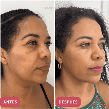 CollageSkin – Mascarilla antiedad con efecto lifting