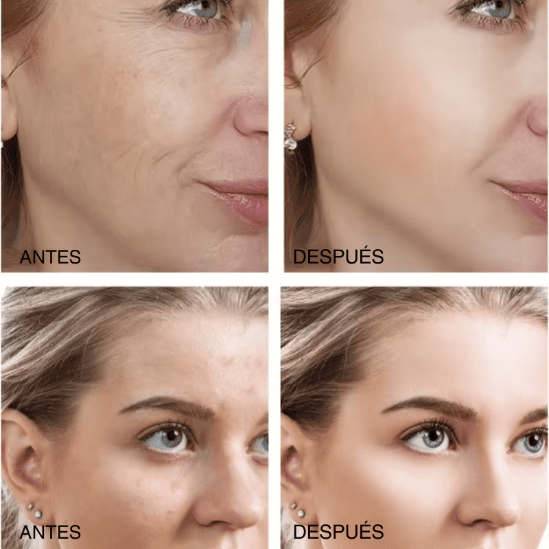 Retinol DermActive – Firmeza, Luminosidad y Juventud