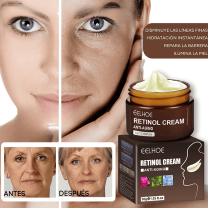 Retinol DermActive – Firmeza, Luminosidad y Juventud