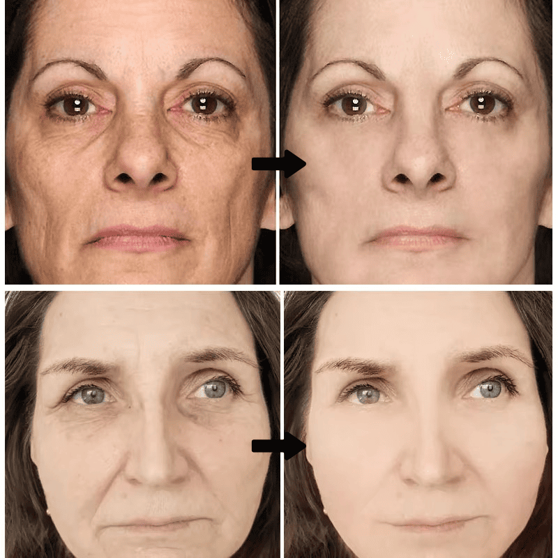 Retinol DermActive – Firmeza, Luminosidad y Juventud