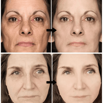 Retinol DermActive – Firmeza, Luminosidad y Juventud