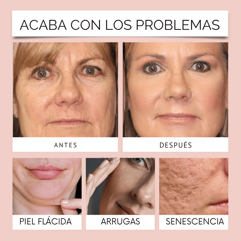 CollageSkin – Mascarilla antiedad con efecto lifting