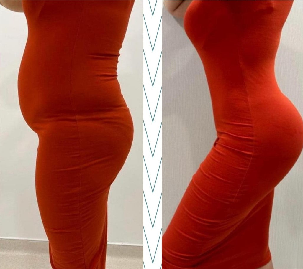 Braga Moldeadora SlimShape - Tecnología Exclusiva FIR ION [COMPRA 1 Y LLEVA 2]