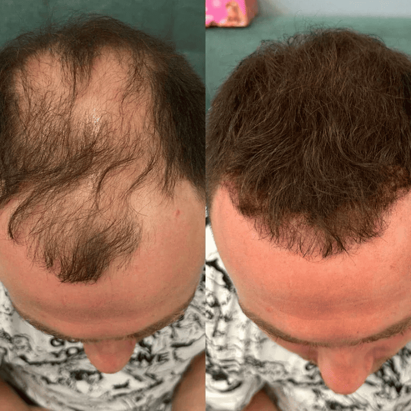 Sevich – Camuflaje Capilar Instantáneo | Acabado Profesional