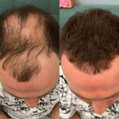 Sevich – Camuflaje Capilar Instantáneo | Acabado Profesional