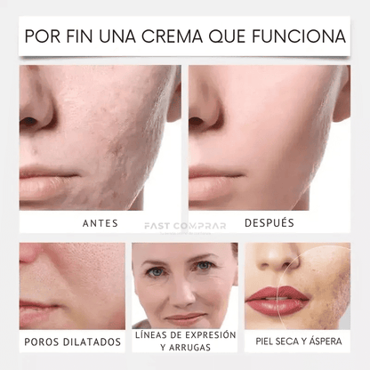 CollageSkin – Mascarilla antiedad con efecto lifting